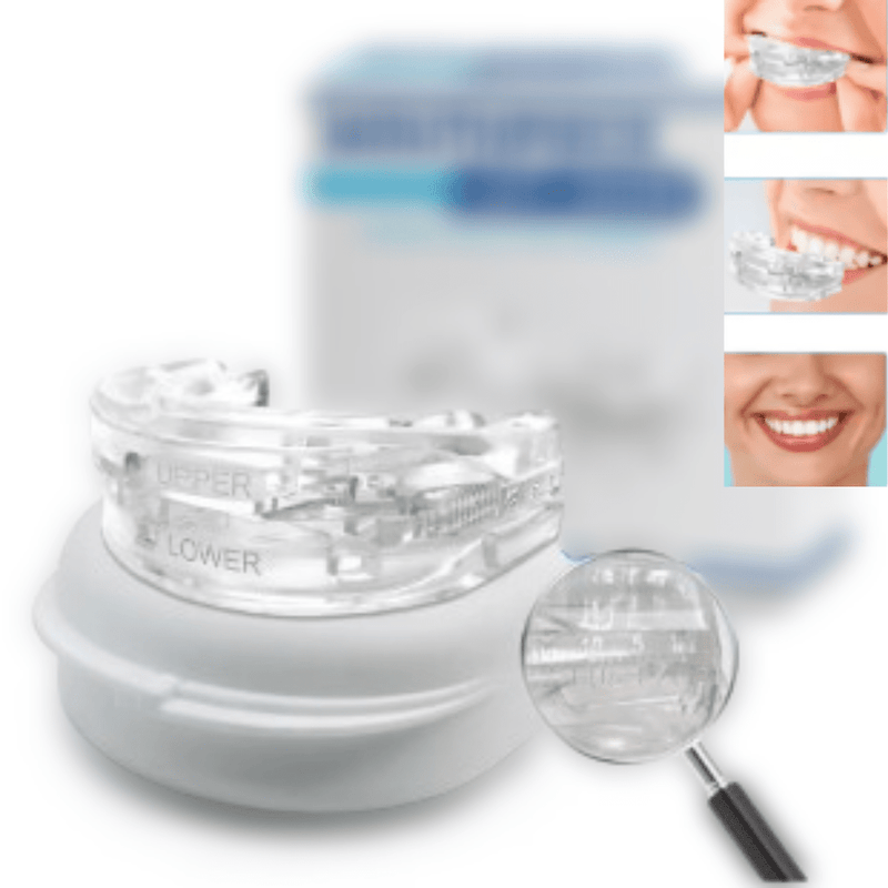 Molde Dental SilentPro Anti Ronco – SilentSleep™ - [Durma com Qualidade]